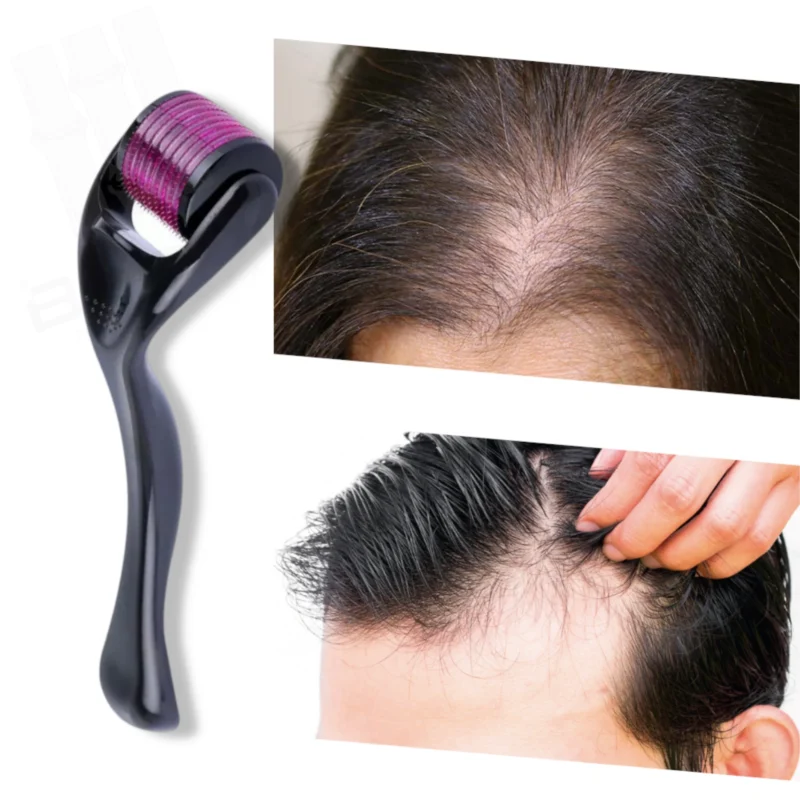 Rodillo Dermaroller de Titanio Negro 1.5mm 540 agujas - Imagen 3